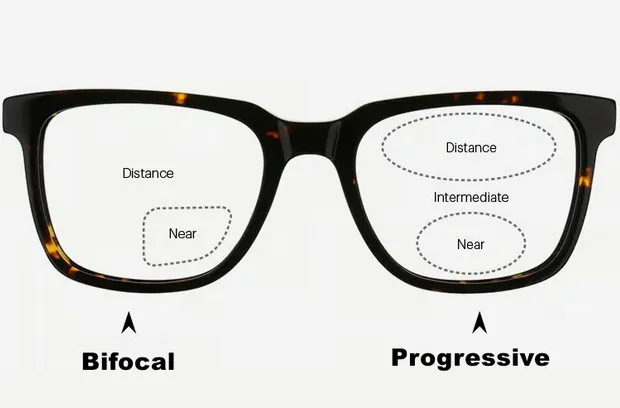 Bifocal vs. Progressive Lenses: Which Is Better for You